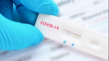 Coronavirus en Argentina: Se registraron 2.486 casos y 88 muertes